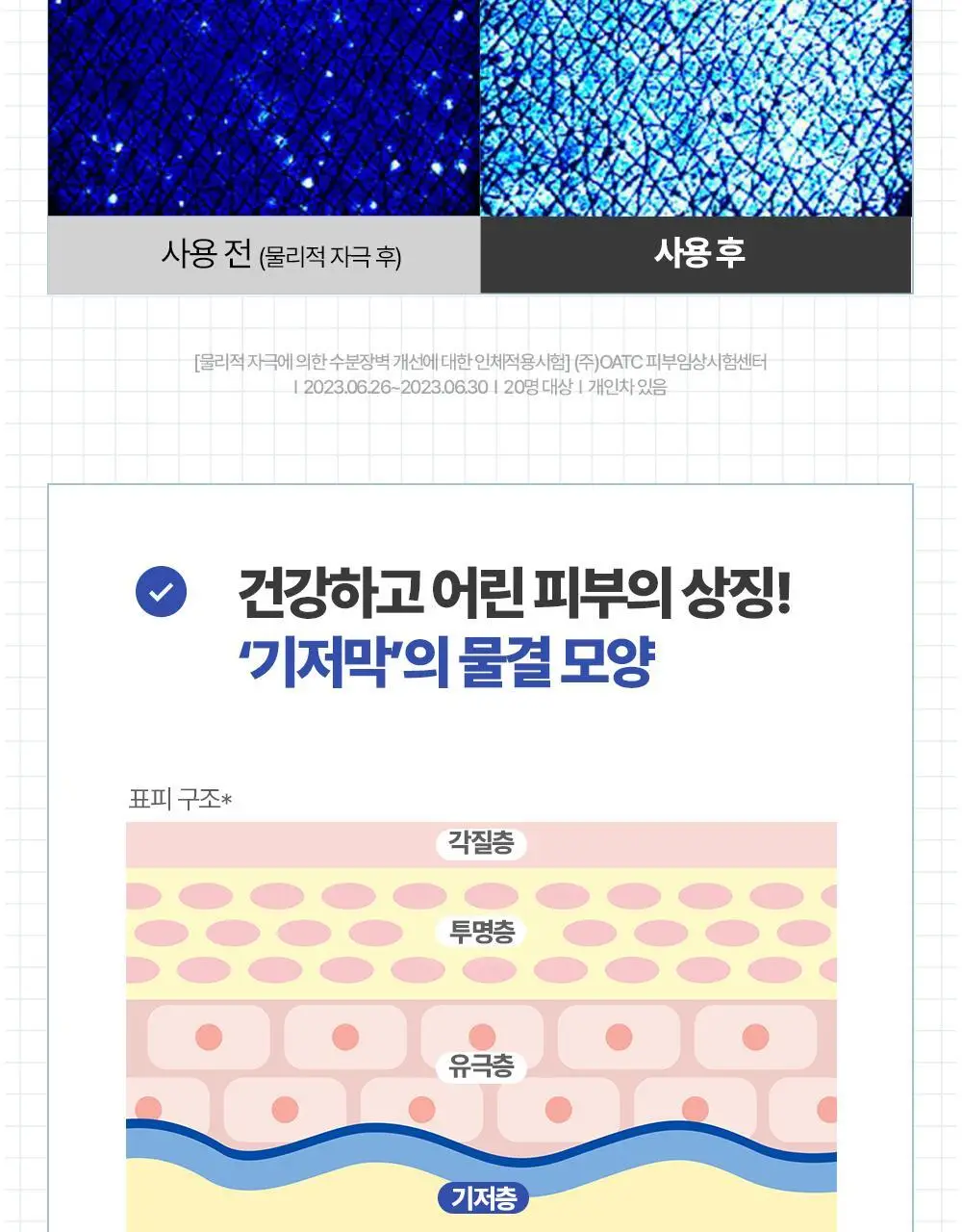 [아기맹수Pick/온라인 단독] 더마토리 히알샷 배리어 앰플 비5 100ml 대용량 기획(100ml+10ml) 상세페이지 19